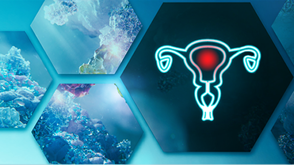 Endometriumkarzinom Symptome 