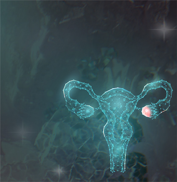 Eierstockkrebs banner bild