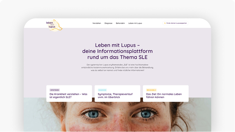 Screenshot der Lupus-leben.at-Website mit Informationen zu Lupus, SLE und Therapie