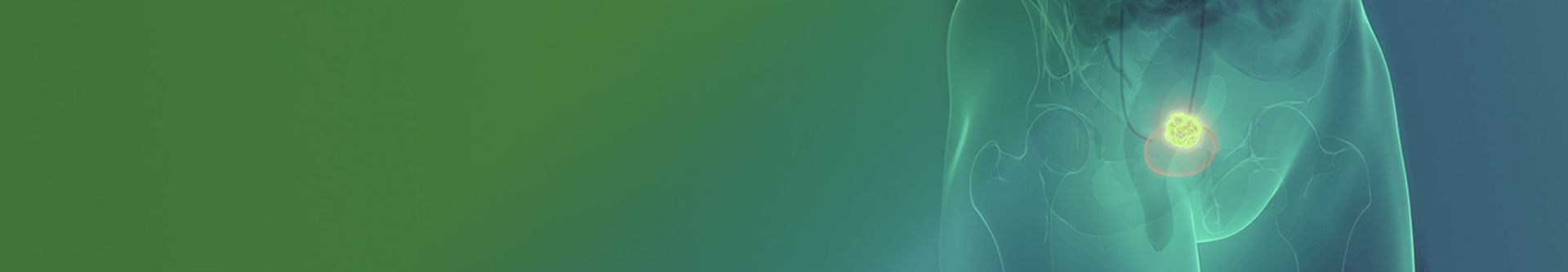 Blasenkrebs banner bild