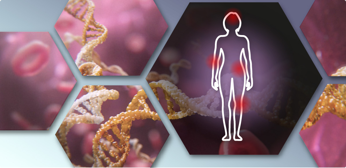 Lupus erythematodes symptome
