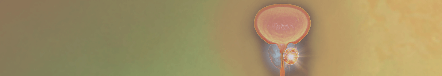 Prostatakrebs banner bild