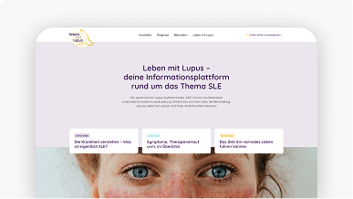 Screenshot der Lupus-leben.at-Website mit Informationen zu Lupus, SLE und Therapie